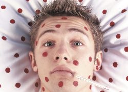 Корь еще бушует.  Спад ожидается  не раньше 2025 года