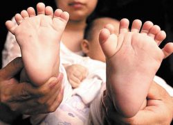 Китаянка родила сына с 31 пальцем